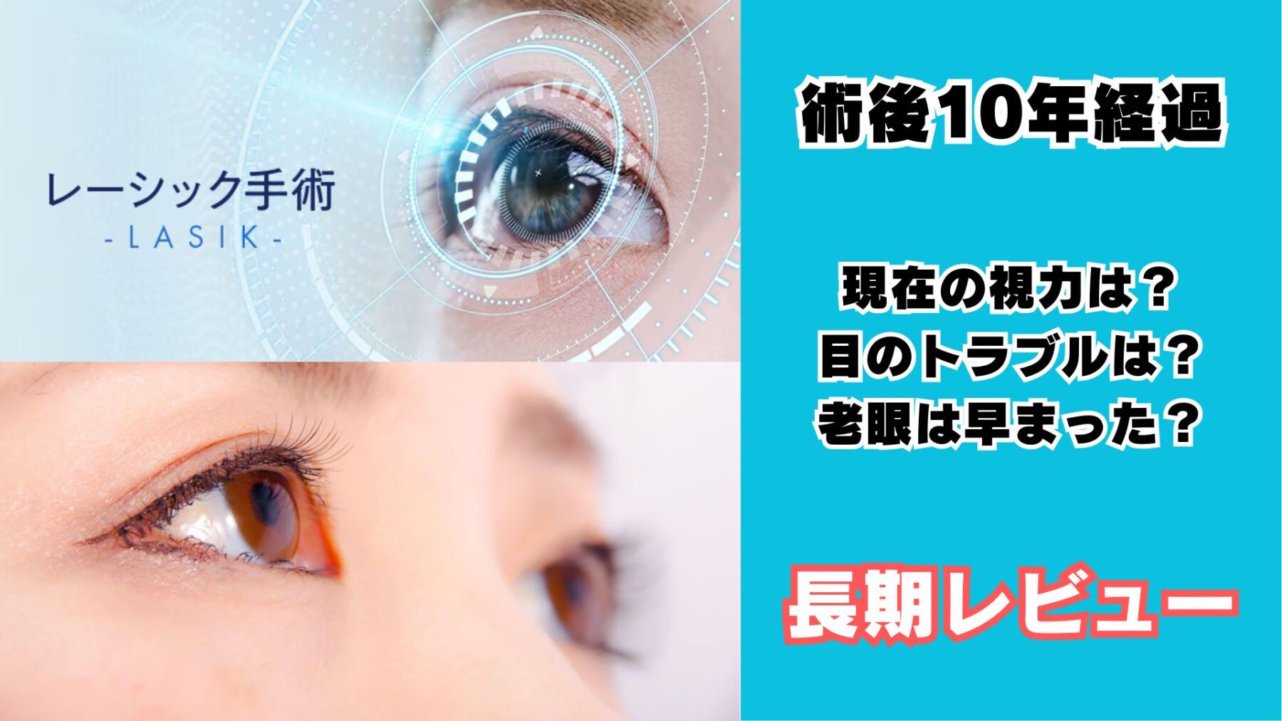 レーシック長期レビュー