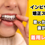インビザライン矯正